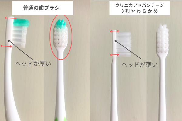 普通とコンパクトタイプの比較